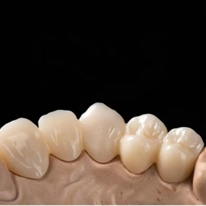 dental zirconia