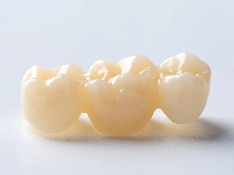 Dental Crown Material